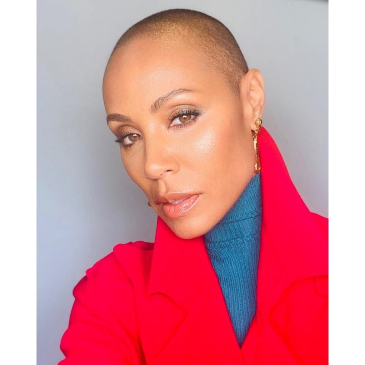 Jada Pinkett/ alopecia